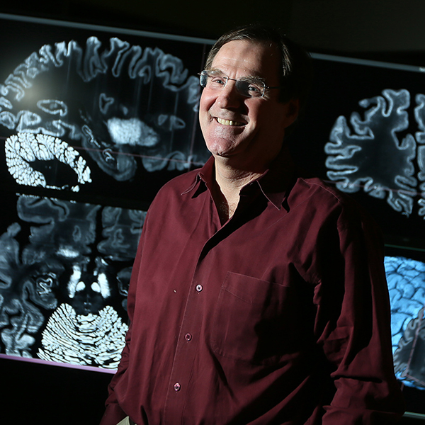 Alan Evan posing in front of brain scans